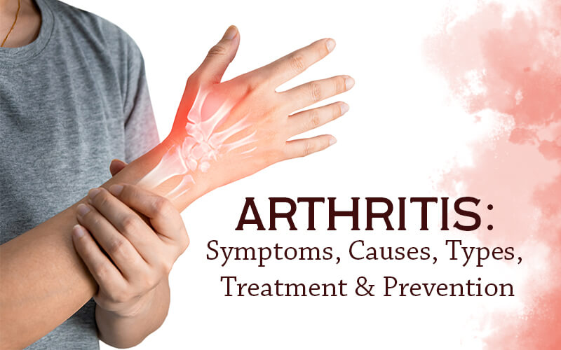 Arthritis