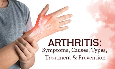 Arthritis